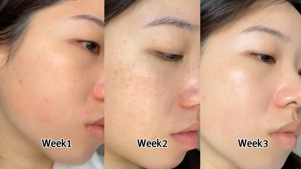 kojic acid soap work kojic acid soap work